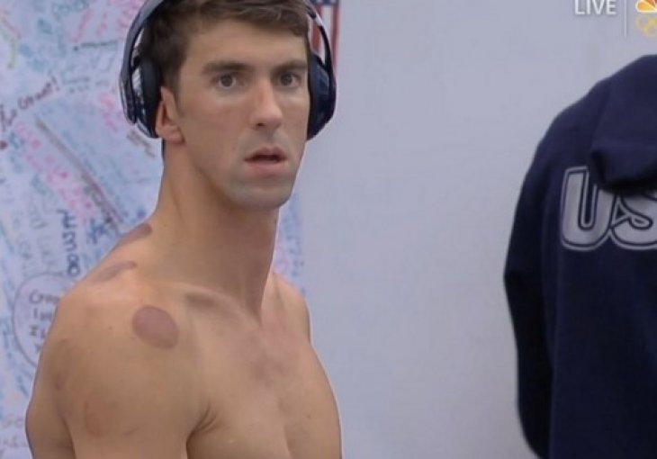 Otkrivena misterija: Phelpsovi krugovi na tijelu su nastali hidžamom