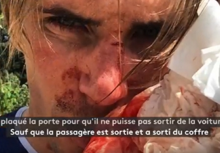   STRAŠNE SCENE U PARIZU: Biciklistu skoro pregazio, a onda ga prebio bokserom i bejzbol palicom (VIDEO)